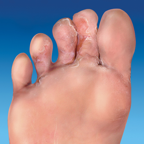 CLn Lavage des mains et des pieds – Nettoyage en profondeur pour les mains,  les pieds et les ongles sujets aux pieds d'athlète, aux champignons et aux  infections – Nettoyant ultime pour